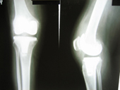 coimbatore-orthopaedic-joint-replacement-maternity-child-welfare-centre-india